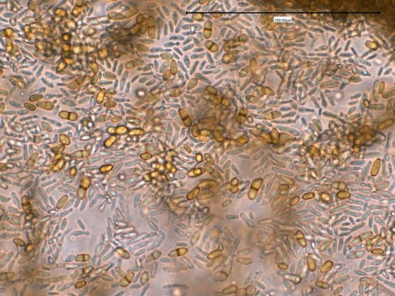 Atlas of Clinically Important Fungi